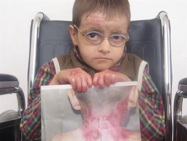 مشارکت در تامین هزینه؛ مرگ و زندگی 