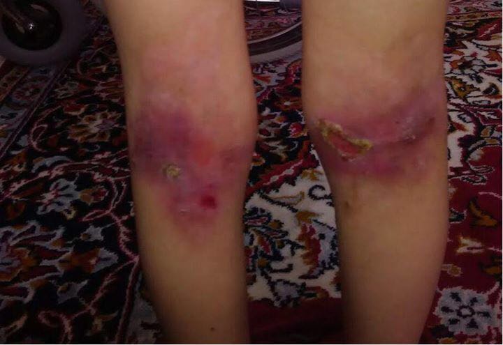 مشارکت در تامین هزینه؛ مرگ و زندگی 