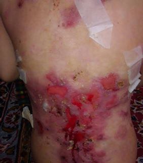 مشارکت در تامین هزینه؛ مرگ و زندگی 