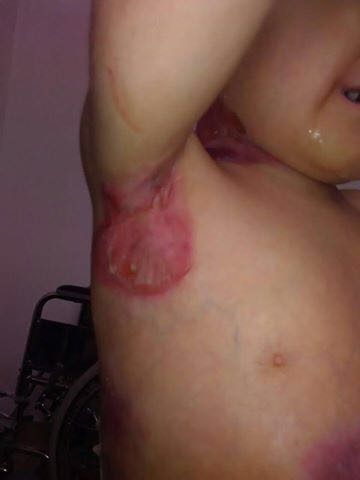 مشارکت در تامین هزینه؛ مرگ و زندگی 