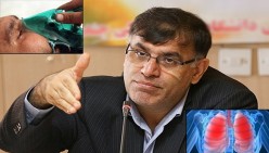 دکتر ایدنی: آسم ناشی از رعد و برق و باران و گرده های گیاهی عامل اصلی تنگی نفس در پائیز خوزستان است